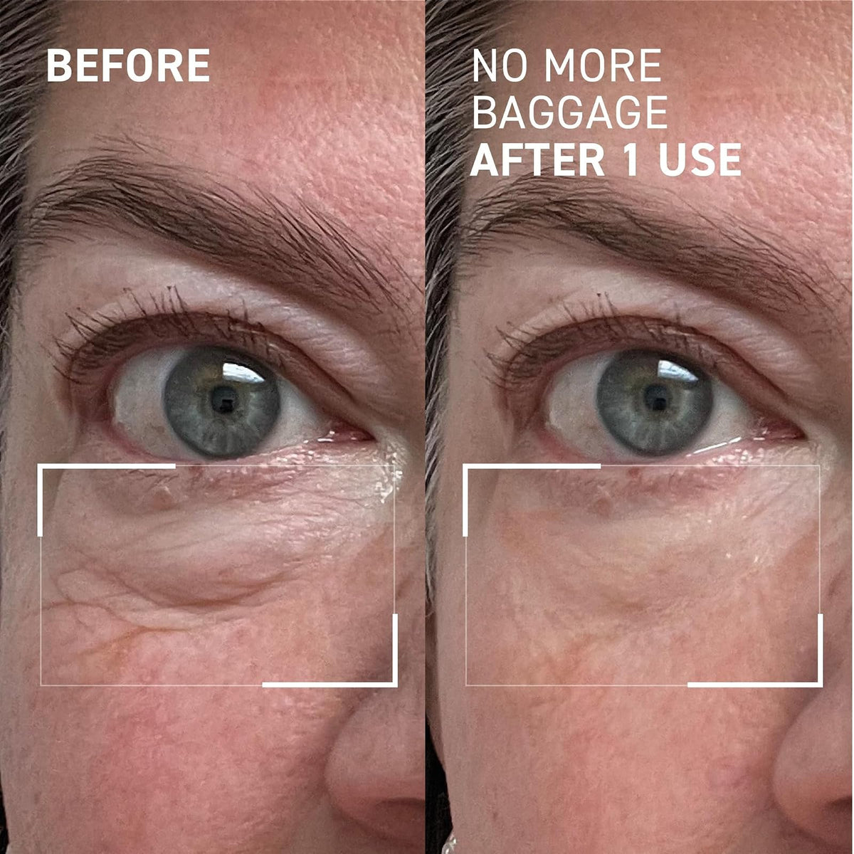 Dr.Brandt Gel desinflamante de ojos, 15 g
