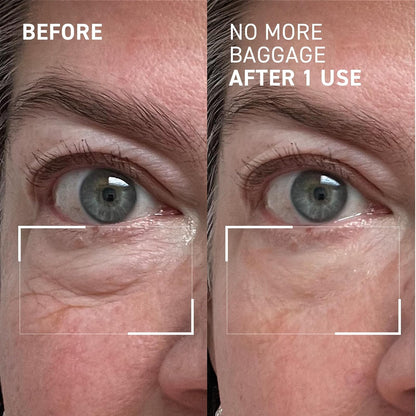 Dr.Brandt Gel desinflamante de ojos, 15 g