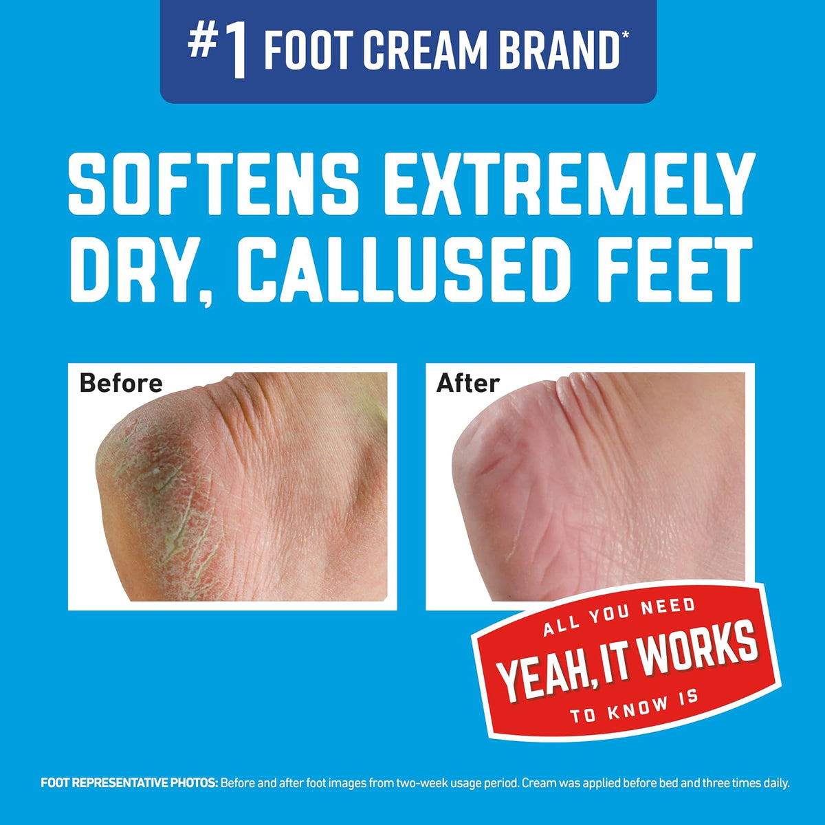 O'Keeffe's Healthy Feet - Crema exfoliante para pies extremadamente secos, agrietados, tubo de 3 onzas, (paquete de 1)