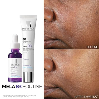 La Roche-Posay Mela B3 Tratamiento Anti-Manchas Corrector, Protector SPF 30 con Niacinamida y Melasyl™, Mejora la Apariencia de las Manchas Oscuras, 40 ml
