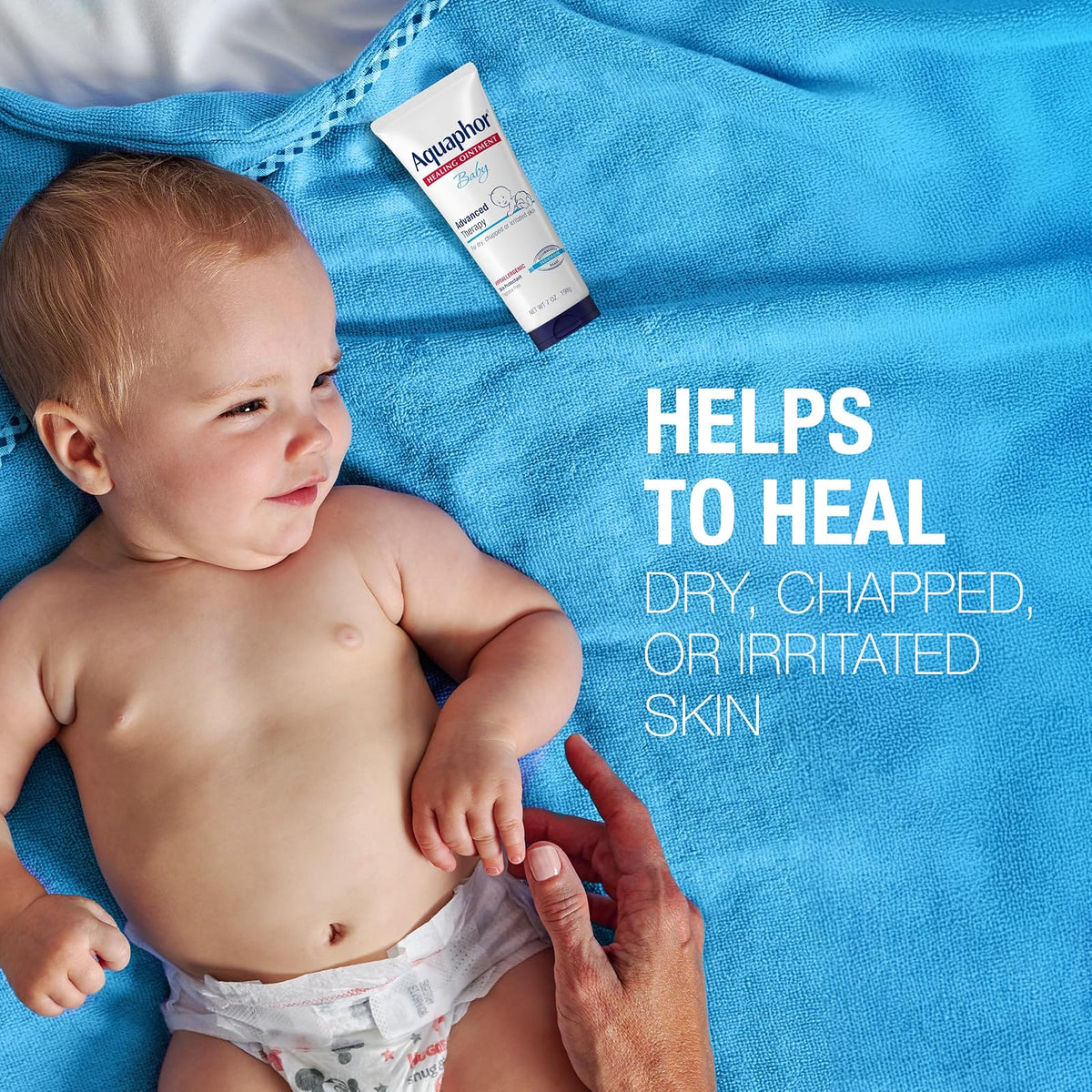 Aquaphor Baby Healing Ointment - For Chapped Skin, Diaper Rash and Minor Scratches - 7 oz. Tube